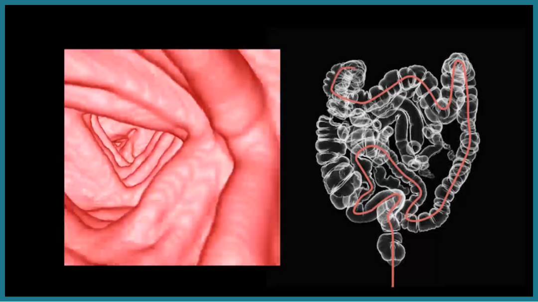 大腸がん検査のイメージ画像
