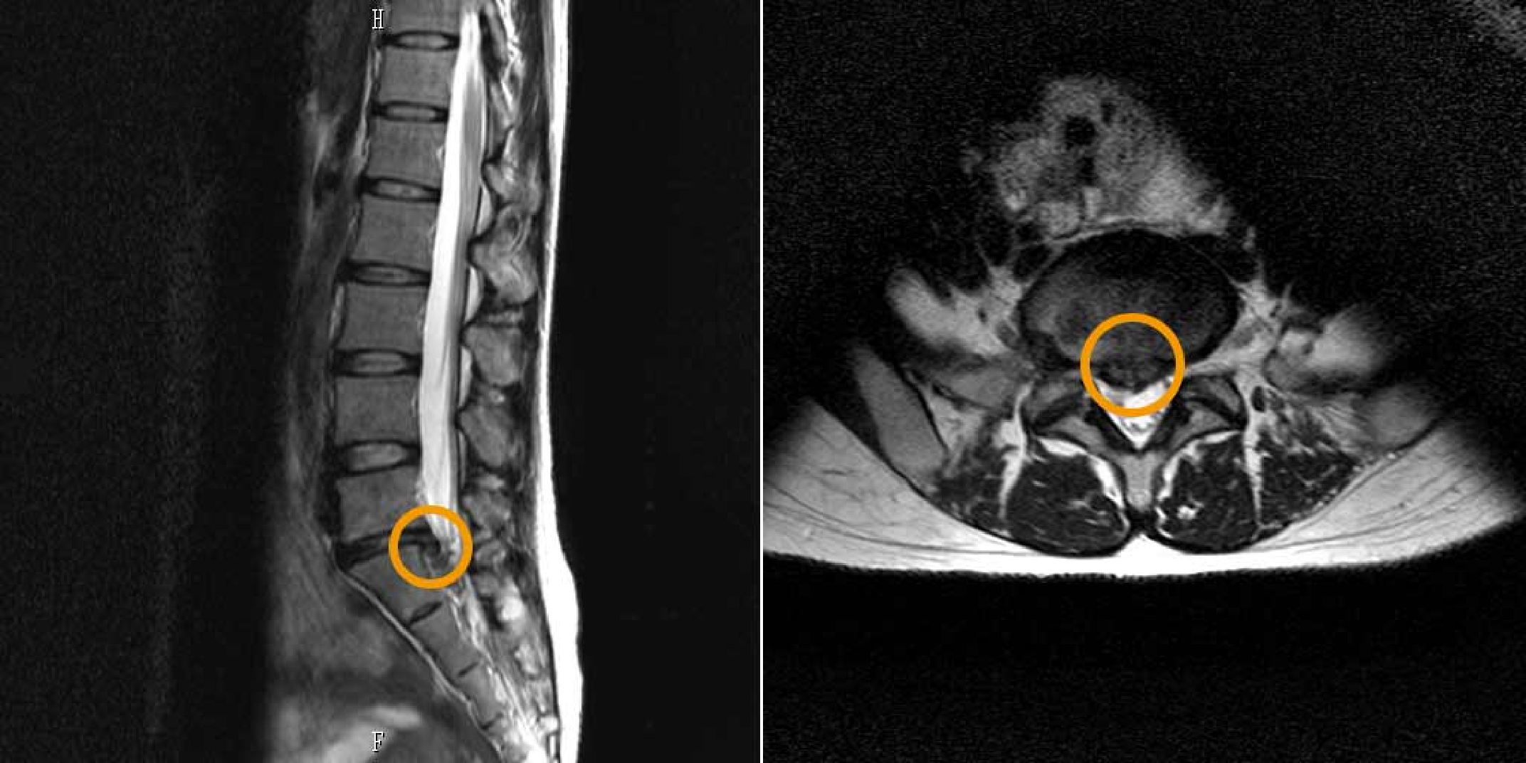脊椎検査のイメージ画像